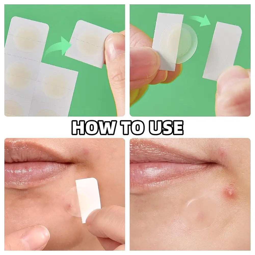 Lunaera™ Precision - 24 Unités