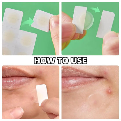 Lunaera™ Precision - 24 Unités